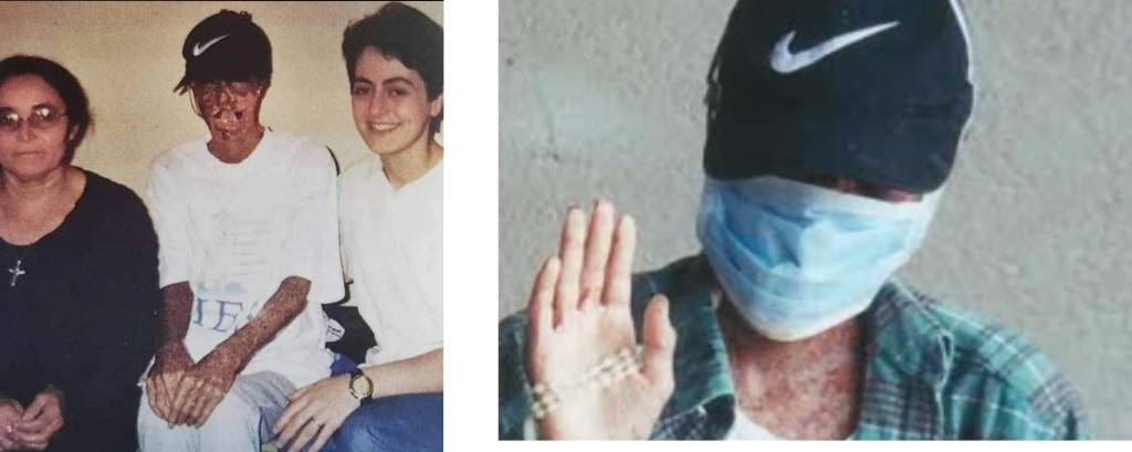 വേദനയിൽ വിരൂപമായ മുഖം സ്നേഹത്താൽ രൂപാന്തരപെട്ടപ്പോൾ!